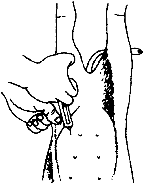 腹腔注射法